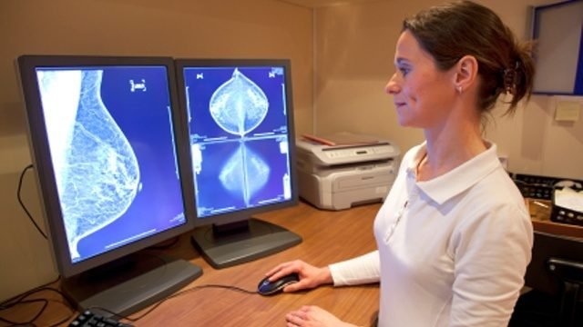 A nurse examines the results of a mammogram.