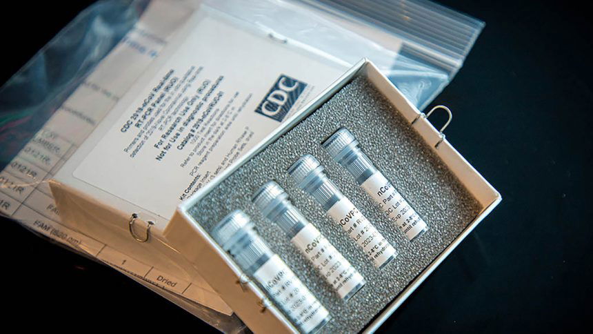 Coronavirus test kit