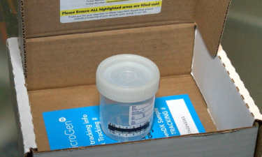 saliva test kit