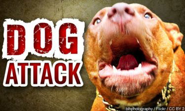 dog attack pit bull