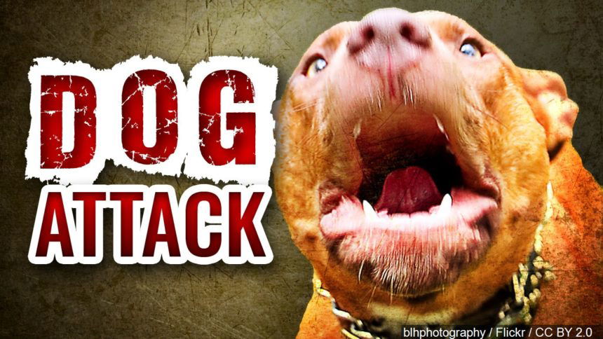 dog attack pit bull