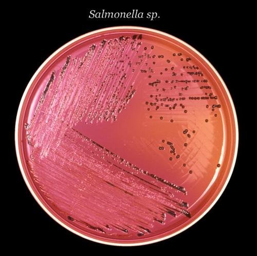 A microscopic look at salmonella.