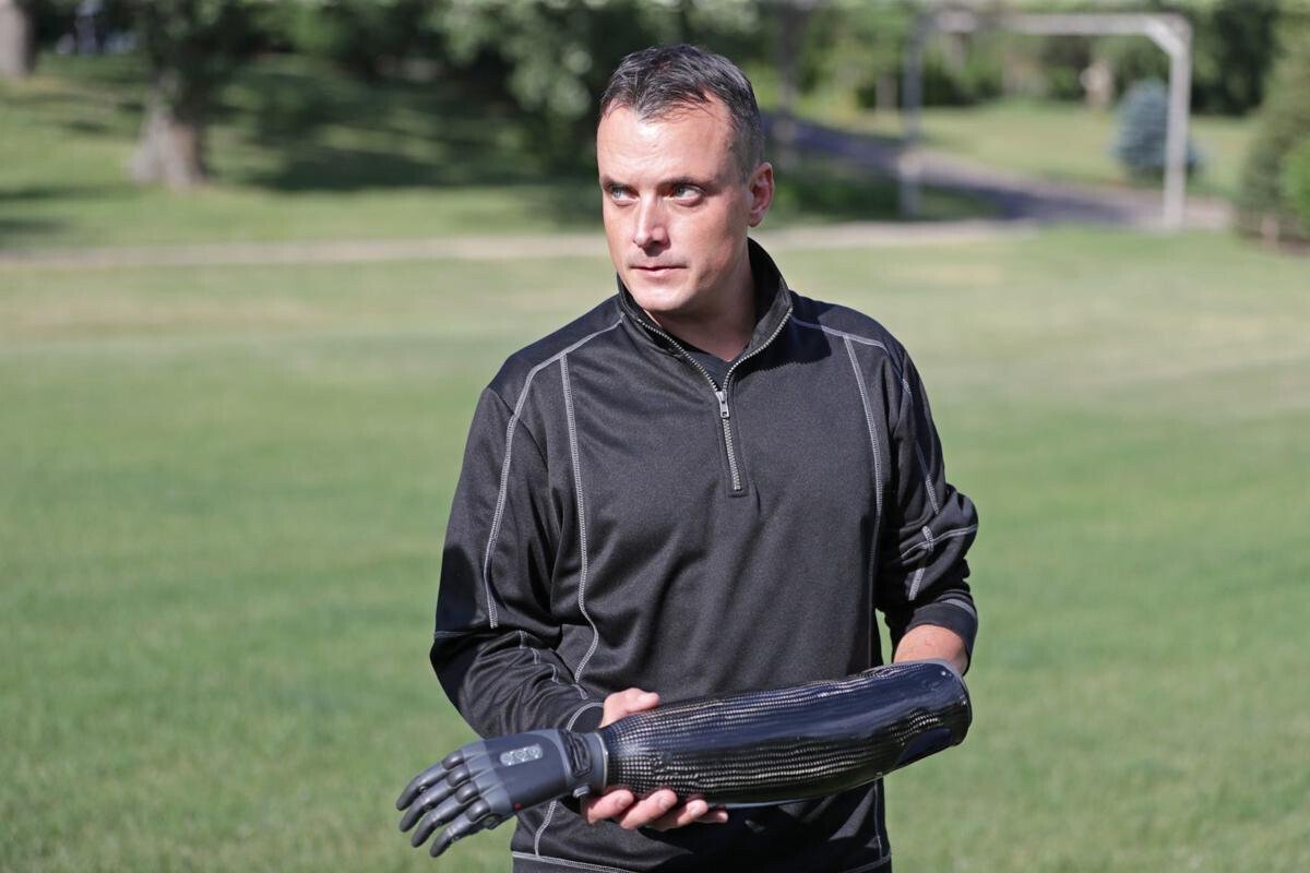 <i>Wisconsin State Journal</i><br/>Ben Shortreed had to have his left hand amputated last year after it was severely injured when a mortar exploded as he was lighting fireworks with friends outside of his town of Verona home. One of his two prostheses responds to sensors on his forearm to allow the hand to open