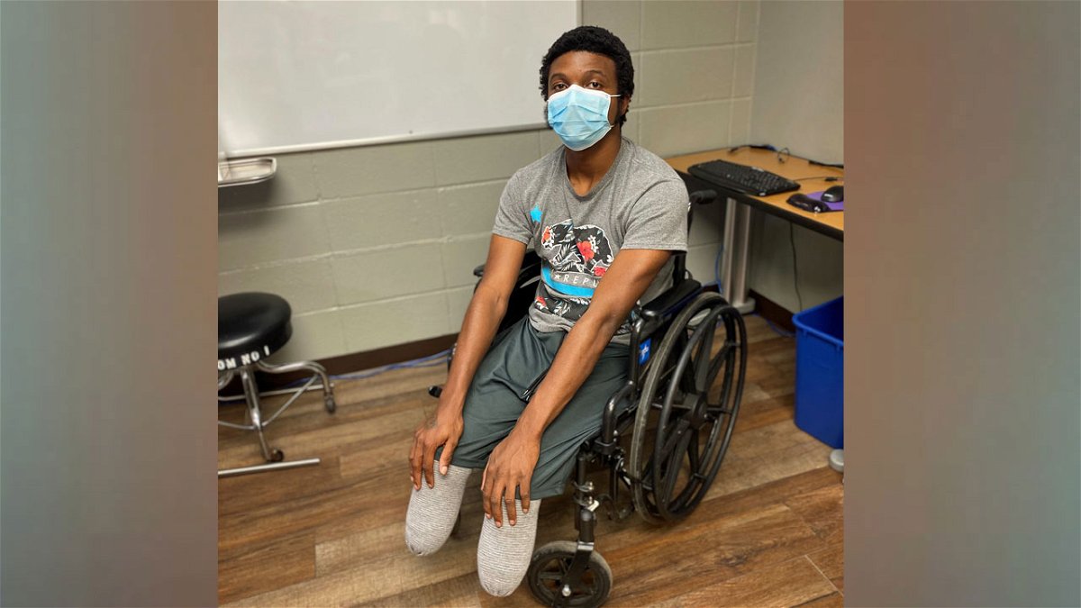 Steven Brown lost his legs to frostbite.