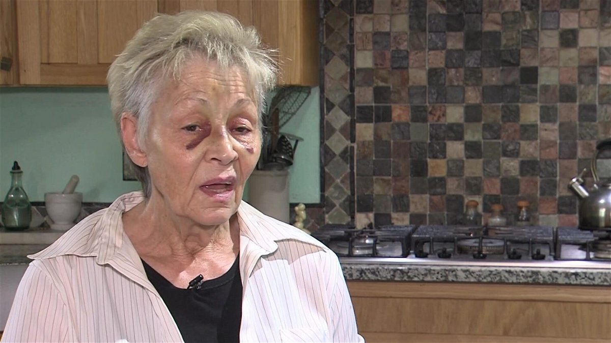 Elderly Woman Attacked By Walmart Employee Speaks Out Kvia 