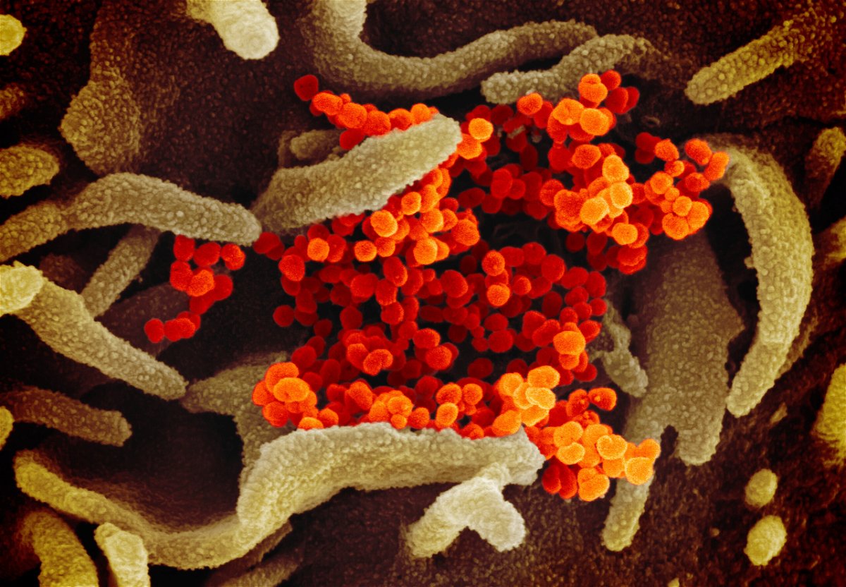 <i>NIAID-RML</i><br/>WHO chief scientist says it's too early to conclude Omicron coronavirus variant leads to mild illness. This scanning electron microscope image shows SARS-CoV-2 (orange)—also known as 2019-nCoV
