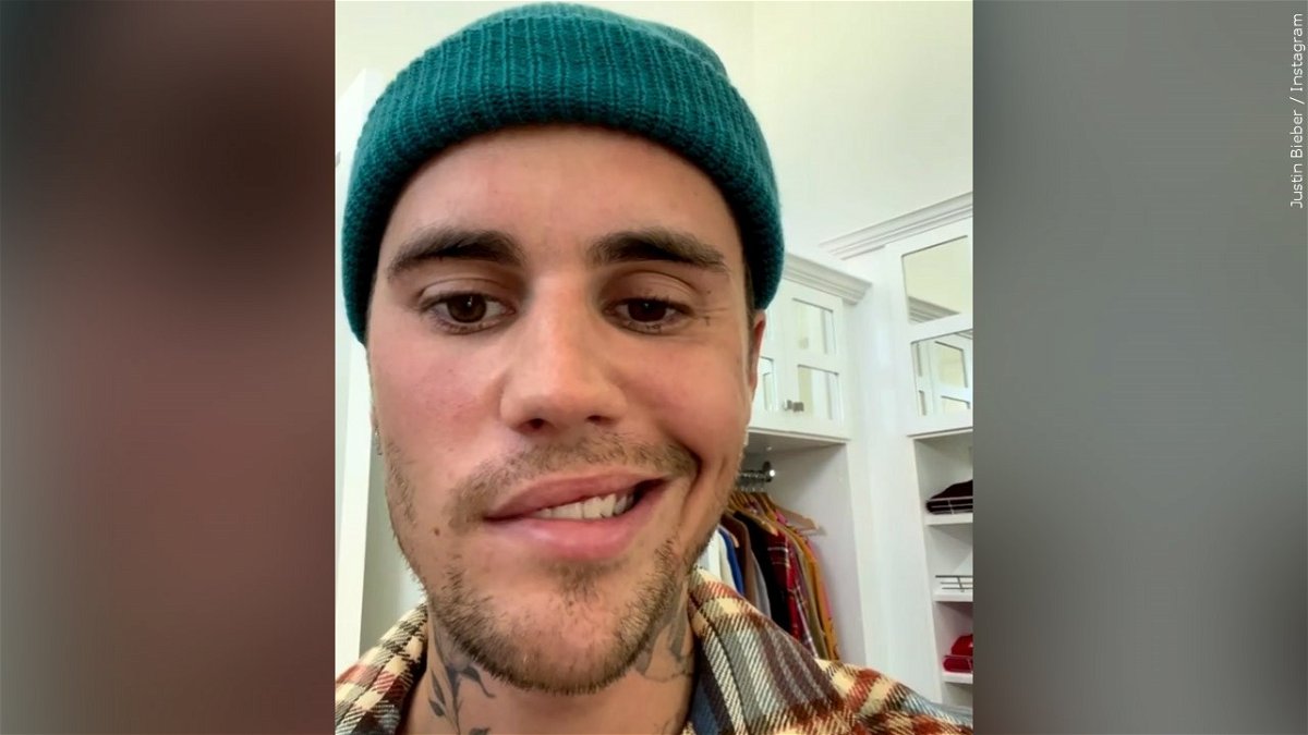 What is Ramsay Hunt syndrome, which Justin Bieber says caused his facial paralysis?