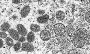 The spread of monkeypox through small virus particles that linger in the air "has not been reported