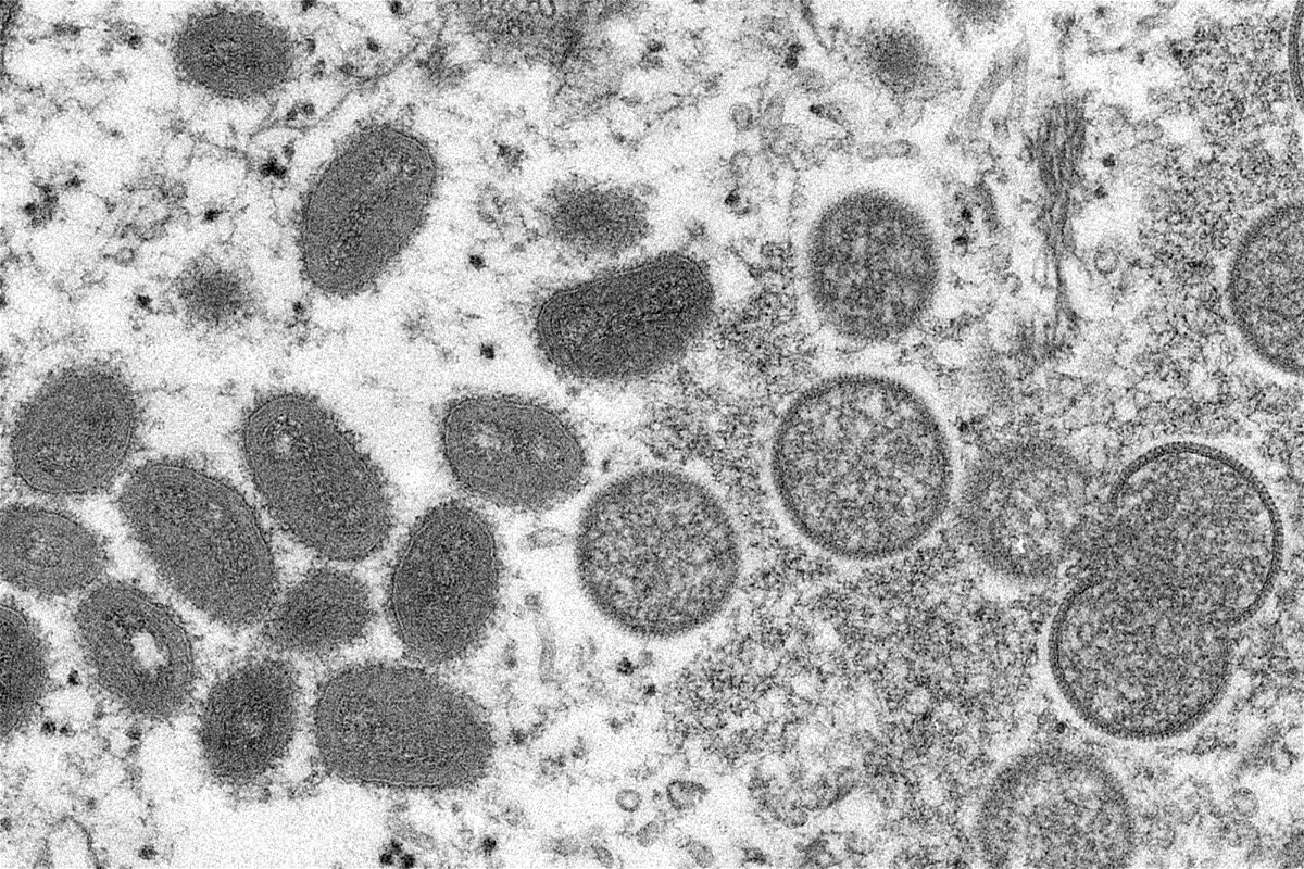 <i>AP</i><br/>The spread of monkeypox through small virus particles that linger in the air 