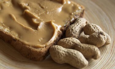 An estimated 2.5% of US children may have peanut allergies