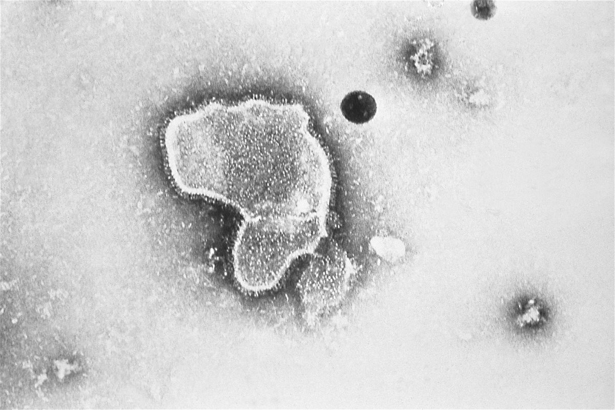 This highly-magnified, 1981 transmission electron microscopic (TEM) image, reveals some of the morphologic traits exhibited by a human respiratory syncytial virus (RSV).