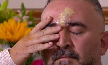 Emil Mammadov had pieces of his face torn off and needed stitches all over his body after two of his neighbor's dogs jumped him Monday around midnight.